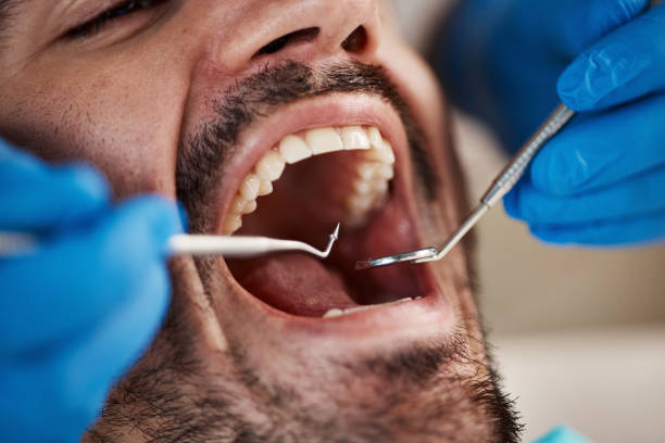 Best Broken or Chipped Tooth Repair in Heartland, TX